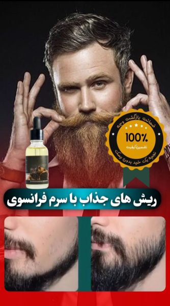 سرم سیر سیاه لاکچری کوئین فرانسه