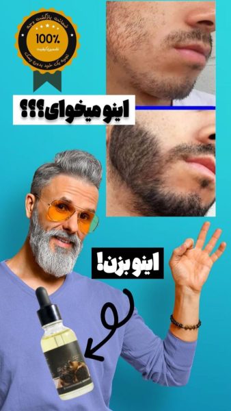 سرم سیر سیاه لاکچری کوئین فرانسه